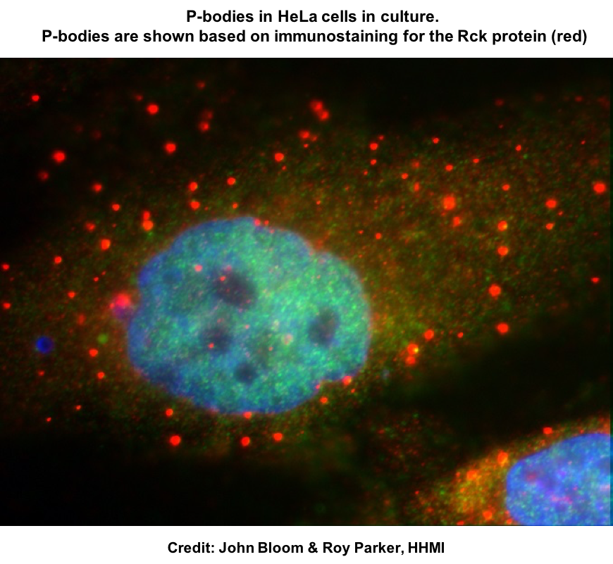 BiomedRevon's tweet photo. #mRNA (de)stabilization—cell response shortcut: IκB #kinases increase *more* transcripts’ degradation in P-bodies than genes' #transcription. But external stimuli may increase #phosphorylation of P-body proteins&amp; stabilize mRNAs for rapid protein synthesis.https://t.co/wQMU5Qjq6j https://t.co/6LL9oIrlv3