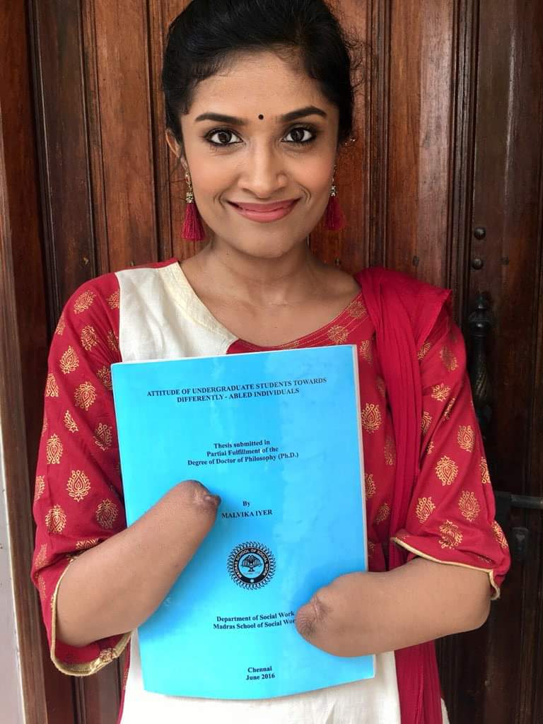 Say hello to Malvika Iyer, Bomb Blast survivor, TedSpeaker, PhD holder. She says,'To evry1 who’s been curious as2 hw I type, do u see tat bone protruding fm my ryt hand? Tht’s my 1&only extraordinary finger.I even typed my Ph.D.thesis with it'.More power to you, lady. The warrior