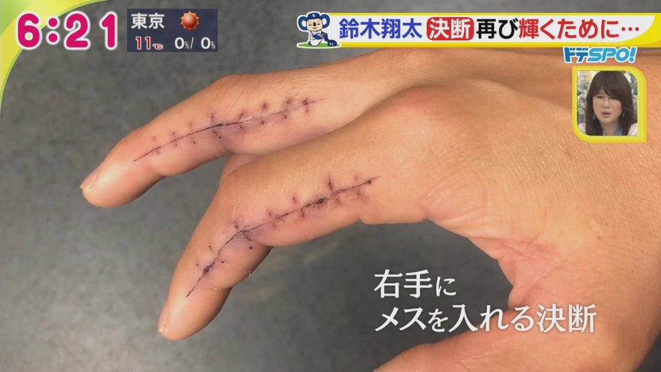 昇る青と貫く赤 23 25 いつもこの手術痕の写真見るたびヒュンってなるの俺だけ 昇る青と貫く赤 23 25 いつもこの手術痕の写真見るたびヒュンってなるの俺だけ
