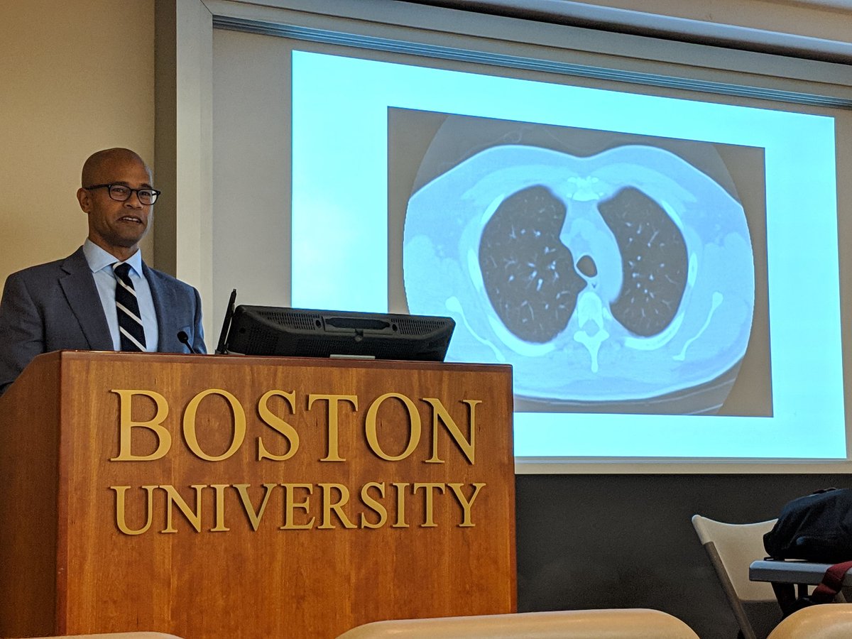 Welcome to Dr. Sidhu Gangadharan offering an enlightening perspective on tracheobroncheomalacia.