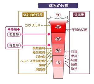 Kato 痛みグラフを見て生理痛の酷い人が初めて出産した時の陣痛が普段の生理痛の痛みと同じだったいってたのを思い出しました Twitter