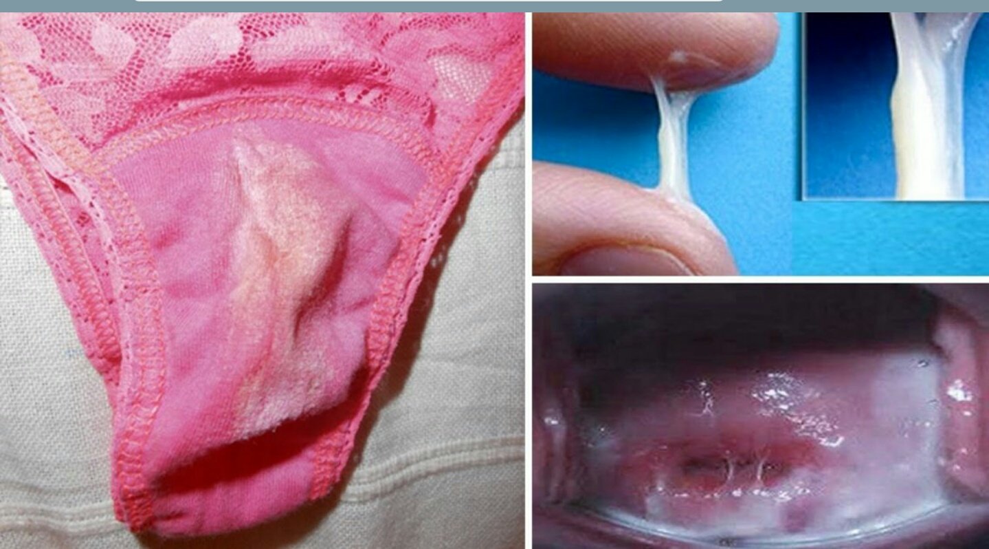 Dr Ems Auf Twitter Has Foul Smelling Vaginal Discharge Has Abnormal Or Irregular Vaginal Bleeding Or Blood Stained Discharge Has A Previous History Of Sexually Transmitted Infection Or Has Been Exposed To A Partner