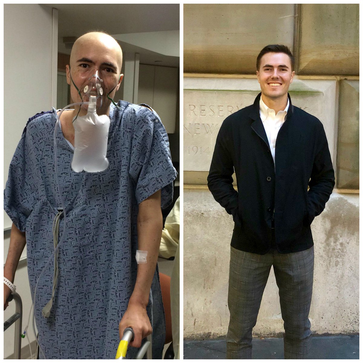 TheJimmyFund's tweet photo. When Casey was diagnosed with leukemia 3 years ago, he felt like #cancer would take away life’s important moments.

Today, with the help of @DanaFarber, he feels like he has gotten his life back and every single one of those moments. “Probably even more than that too,” he says. https://t.co/UFDv6bA1Sp
