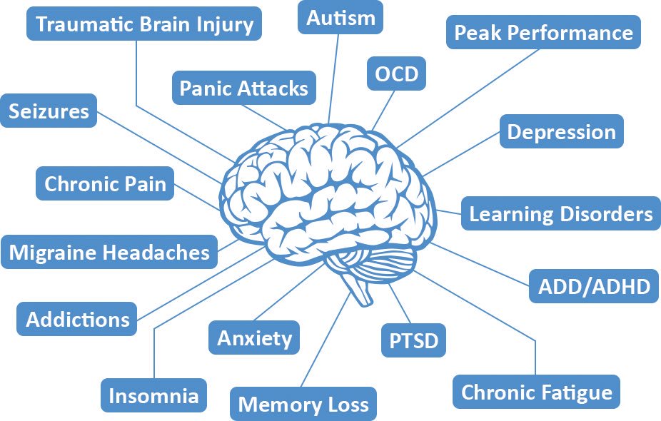 zone_serenity's tweet photo. #Neurofeedback #mindfulness #trainyourbrain #change your life #brainfitness #gymforthebrain #ADHD #peakperformance #abundance #happiness #achieve #brainhealth #stress #faith #growth #abundance #lawofvibration #possible #serenityzonetherapy.com https://t.co/s0fBhlvd2L