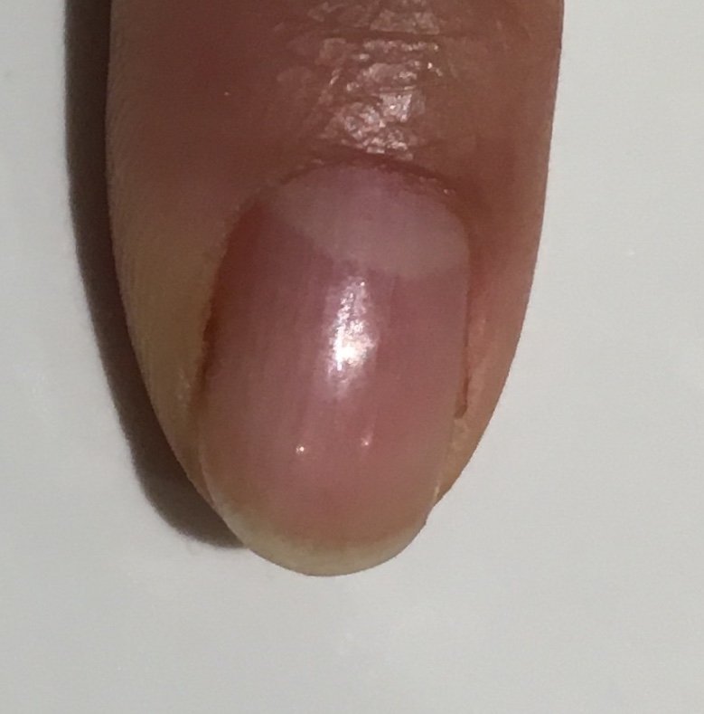 2_naturelle's tweet photo. Do you have split nails? For #tips on preventing splitting &amp; to strengthen your #nails, check out our latest Insta post here: https://t.co/0yMdXnVCvS
Our #allnatural 'SHE NAILED IT' nail hardener is perfect for preventing #splitnails, so be sure to stock up for the holidays! https://t.co/A1hPpsVCeH