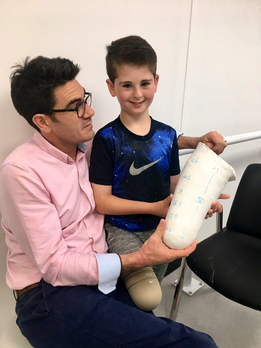 BladeBoyRio's tweet photo. #TB Rio’s Oct/Nov #column @PosAbilityMag Rio writes about being fitted for his new @ottobockuk #prosthetics by @mat_dorsetortho @DorsetOrtho and choosing a new @funkifabrics design for his day leg socket #DorsetOrthopaedic #StriveForBetter #PosabilityMagazine #NothingIsImpossible https://t.co/oklmloNVbv