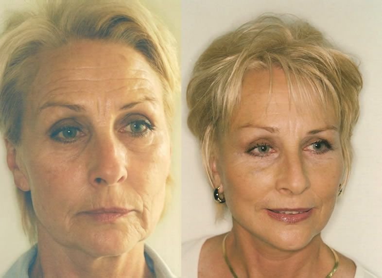 Your Energy At Home Facelift Accomplished From Face Yoga Workouts goo.gl/lWDvf