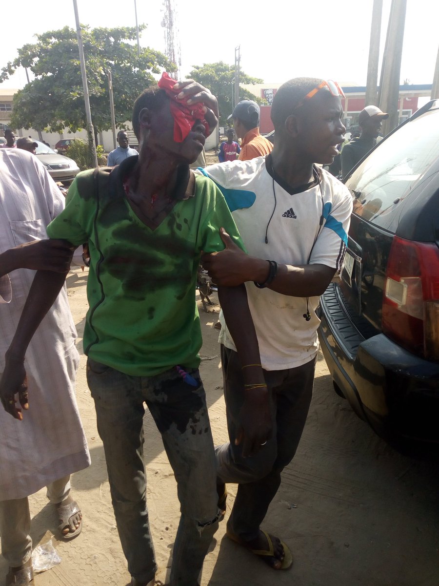 EruditeMee's tweet photo. Nigerian Hospitals: are they out to save lives or out to make money? SHEPHERD hospital @Festac this afternoon refused treating an accident victim whose scalp(head) got split. This is inhumane @Gidi_Traffic Pls RT till it gets to the right authorities https://t.co/5H4J1YbfE3