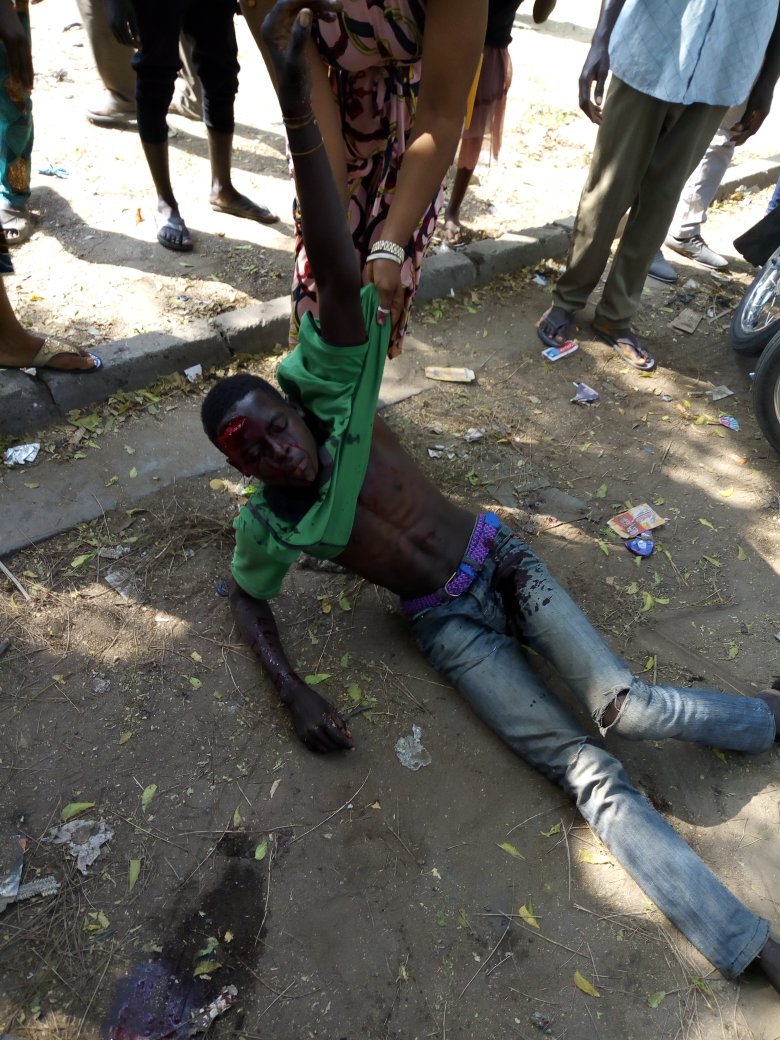 EruditeMee's tweet photo. Nigerian Hospitals: are they out to save lives or out to make money? SHEPHERD hospital @Festac this afternoon refused treating an accident victim whose scalp(head) got split. This is inhumane @Gidi_Traffic Pls RT till it gets to the right authorities https://t.co/5H4J1YbfE3