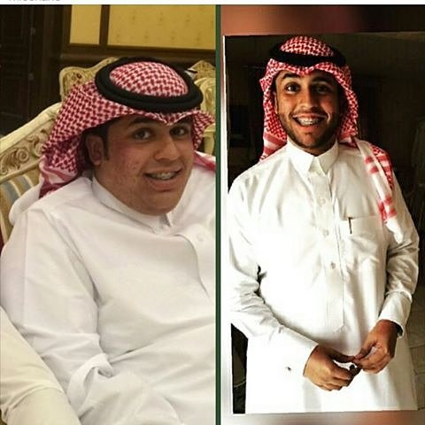 rolla89241786's tweet photo. #ليفربوُل_مانشّستر_يوُنايِتد
#هّل_من_الممكن_تتزوَجيِن_مدخَن_اولا
تخلص من الكرش والترهلات وانزل 14كيلو
💪💪💪💪
 خلال 30 يوم بدون مضاعفات او اضرار للجسم.🍁
المتابعه بشكل يومي
💪💪
للطلب و الاستفسار راسلني مباشره  على الواتس اب في التعليق https://t.co/OXWsLNg2ui