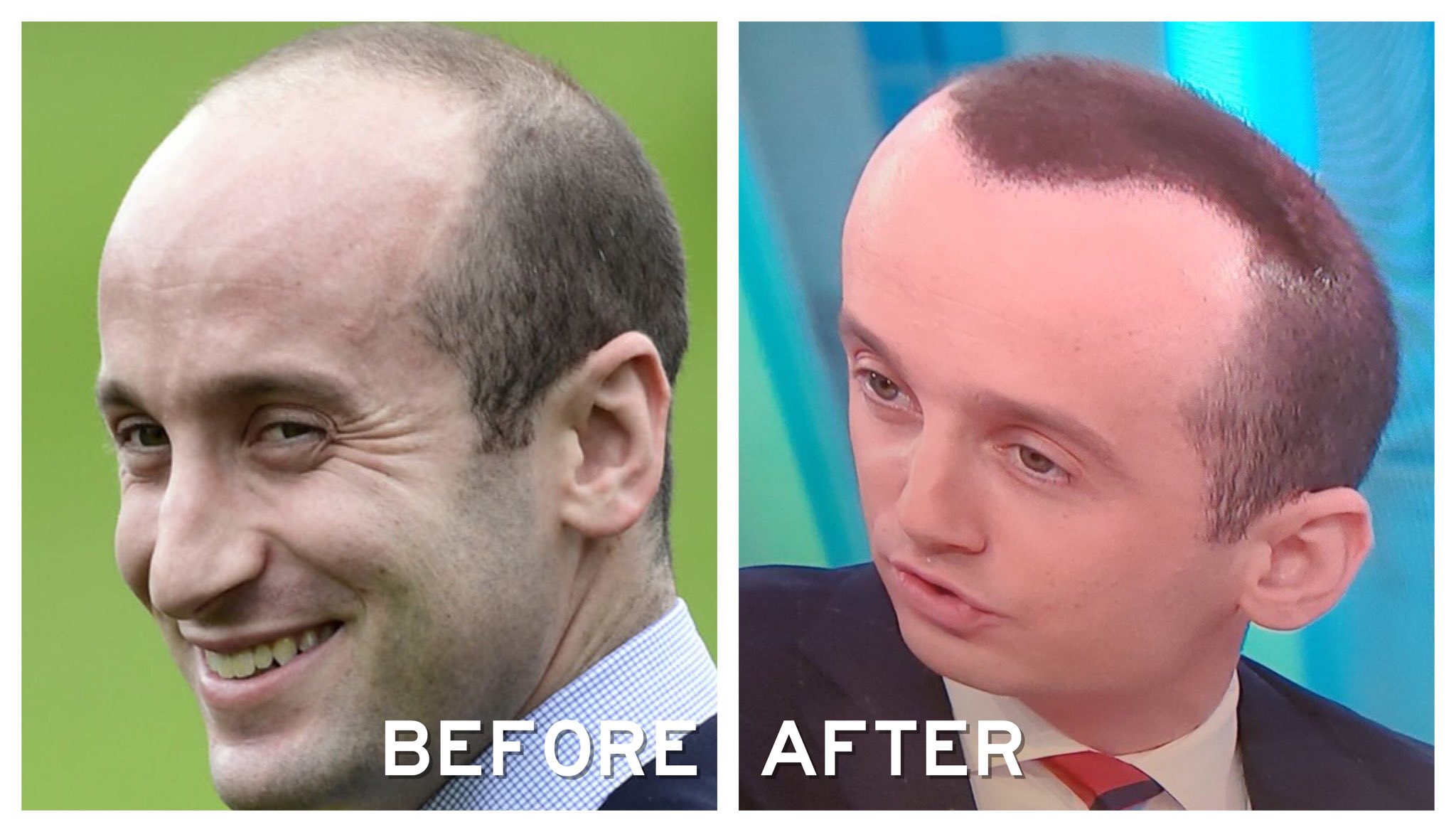Elelegante101 On Twitter Stephen Miller Spray On Hair Informercial Https T Co Jig2xvleez Twitter