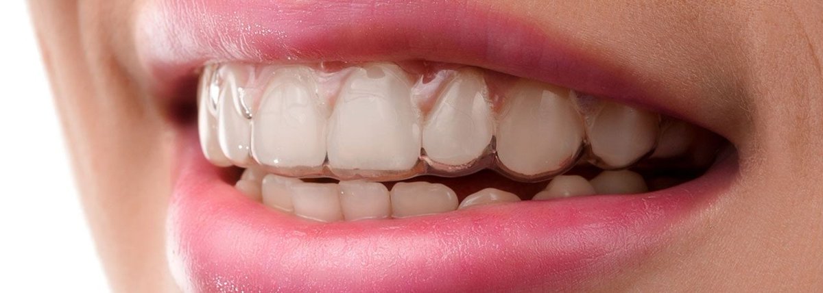 Perfect Smile Aligners tweet media