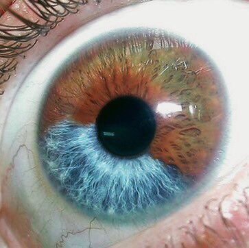 lavieimiitelart's tweet image. sectoral heterochromia