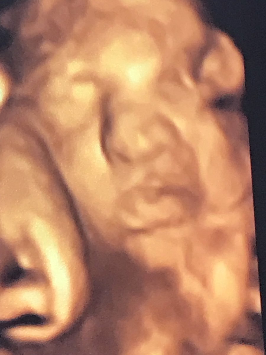 AlexisMitchem's tweet photo. Our daughter is so perfect 💗 she started blowing kisses for her daddy during the ultrasound https://t.co/y68CfK8aFc