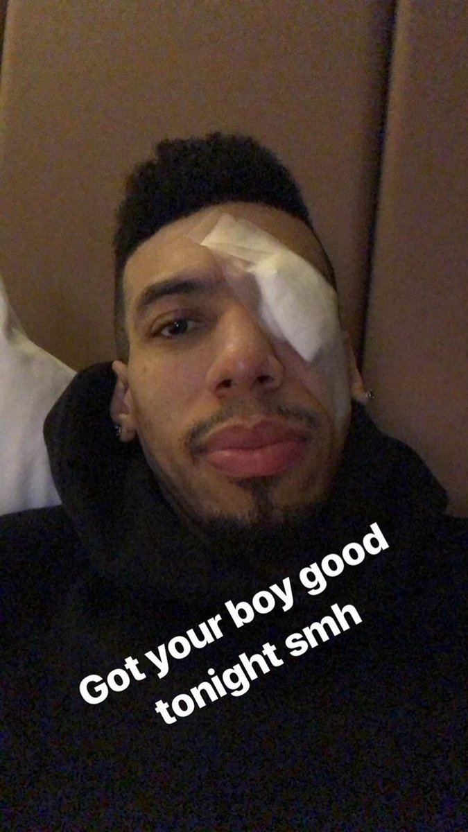 Josh Lewenberg On Twitter Danny Green Rocking The Pirate Look After Getting Poked In The Eye Tonight Via His Ig Much Needed Day Off For The Wounded Raptors Tomorrow They Don T Play