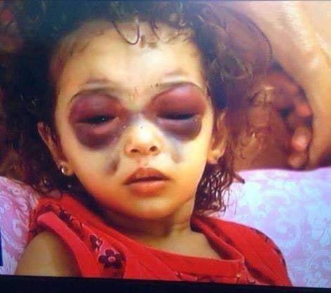 tongoy's tweet photo. @realDonaldTrump In case you get lost, this is what the pedophile Zionist Jews are doing to the Palestinian terrorists. AND YOU ARE PAYING THEM WITH OUR TAXES. https://t.co/VQjnBdjTdc
