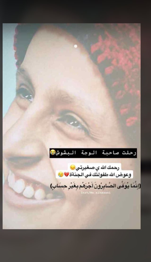 #ميسون_الرواحي_في_ذمه_الله
ﻳﺤﻜﻰ ﺍﻥ ﻃِﻔﻠَﺔ ﻣُﺼابة ﺑـِ السرطان ﻗِﻴﻞَ ﻟَﻬا ماهي ﺃُﻣﻨْﻴﺘُﻚ؟. ﻗَالت ؛ ﺃﻥْ ﻳُﺼاب السرطان ﺑِﺂﻟﺴّﺮﻃﺎﻥْ ﻓَﻴﻤُﻮﺕْ
رحمة الله عليكِ💔.