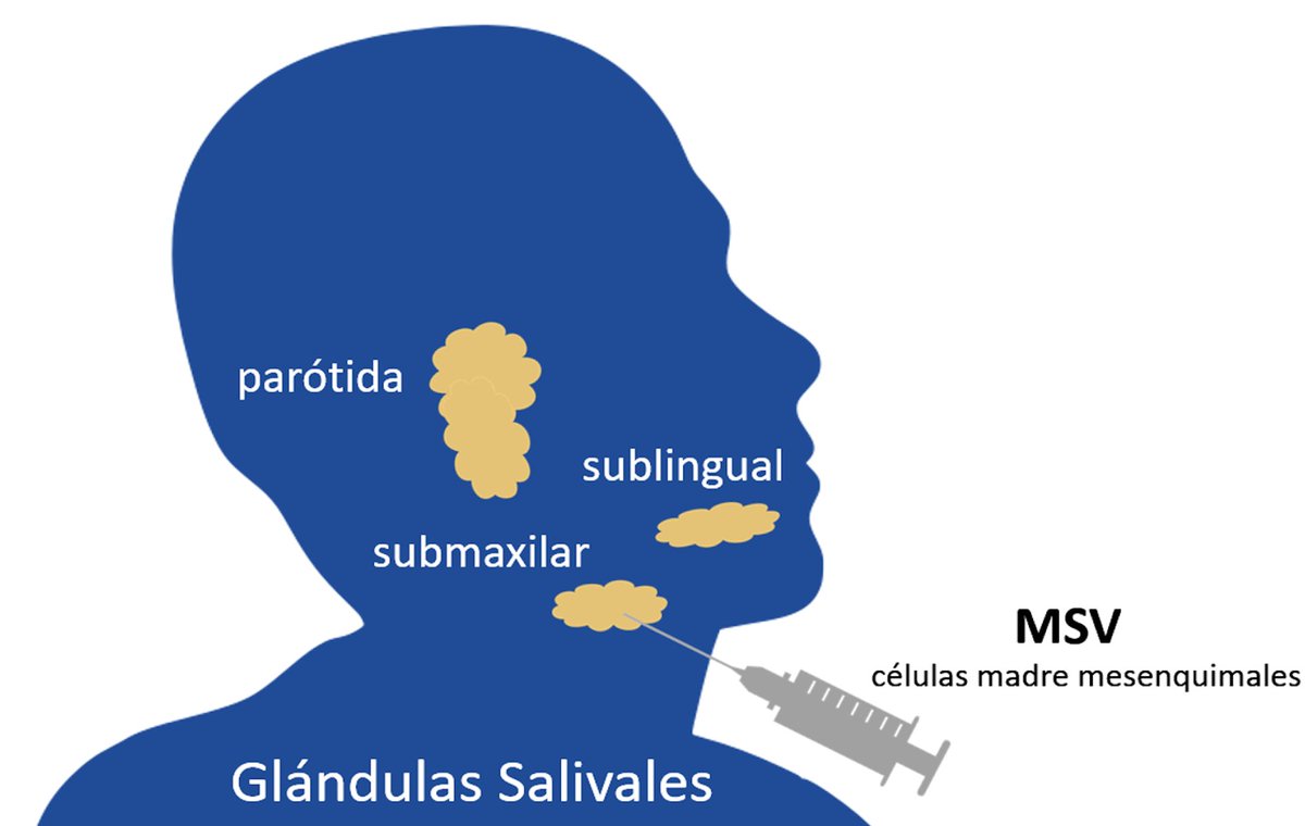 itrtbcn's tweet image. La Agencia Española de Medicamentos ha aprobado el desarrollo del #EnsayoClínico, promovido por #ITRT, para evaluar el efecto de la infiltración de #célulasmadre en #glándulassalivales, atrofiadas por radioterapia debido a cáncer de boca. + Info: itrt.es