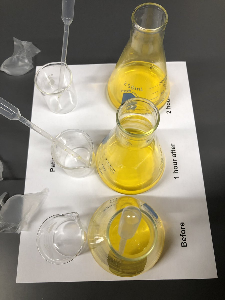 warriorsci1's tweet image. Advance Biology began their macromolecule unit last week. They will spend a detailed amount of time on each class, starting with carbohydrates. Here they analyzed glucose levels of three patients to determine if they were diabetic or not. #warriorstrong #sciencestrong #apbiolife