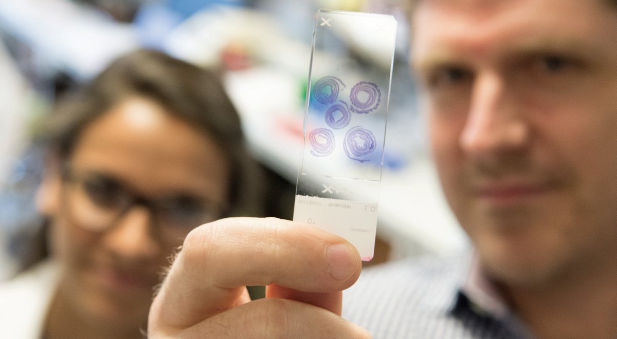CRISPR-Cas9 gene editing system and Cancer?
oncology.euroscicon.com
#Scientists report #CRISPR restores the effectiveness of #LungCancer #Treatment
#Oncology #CancerReserach #CancerTherapy #CancerBiomarker #CancerMetastasis #CancerTreatments