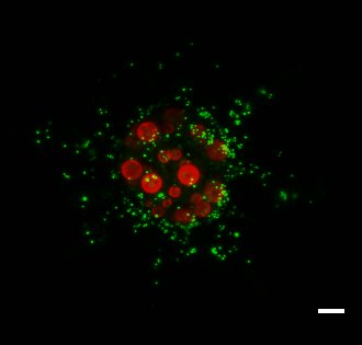 MargaretBrisbin's tweet photo. Deck the halls with Acantharea (and their Phaeocystis symbionts)! I hope these #tinypretty acantharians help you feel holiday cheer this #TinyPrettyTuesday! 🤶 🎄 #protists #plankton #symbiosis #microbes #radiolaria https://t.co/8exFl7aiKH