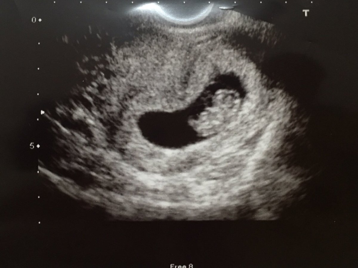 お仕事と切迫流産 さいとうん家