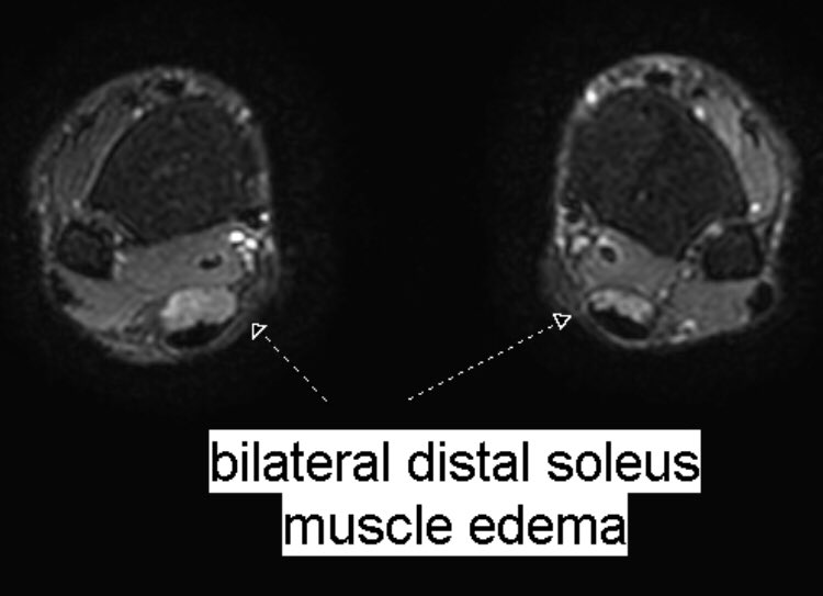 Benoît Rizk on Twitter "Same 27 y.o. runner presented yesterday with