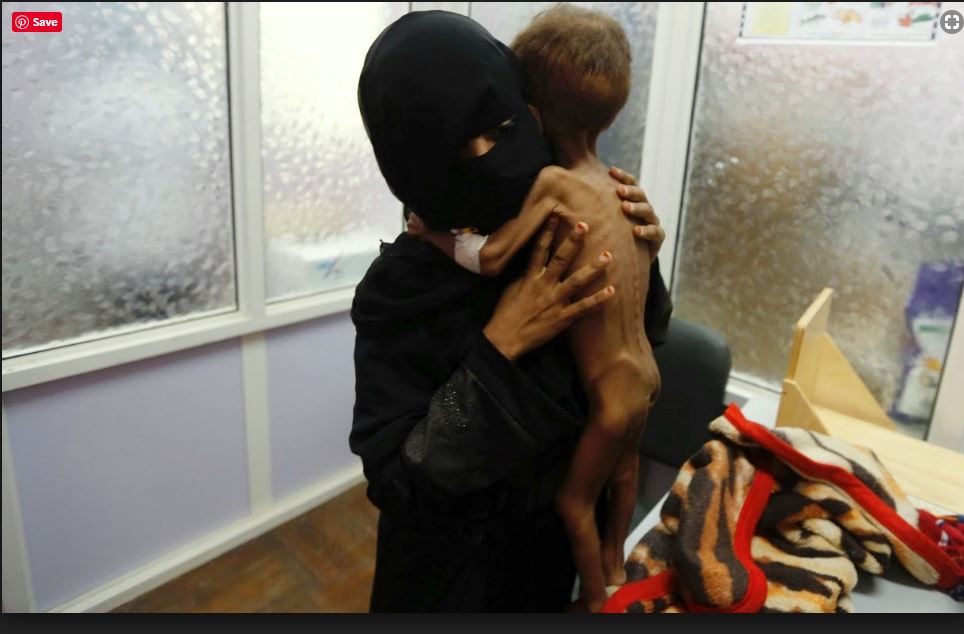 Just imagine if next to every picture of a starving Yemeni child published was a picture of those responsible. Atrocity visualised without responsibility adds up to little more than voyeurism and £5 a month if you please.