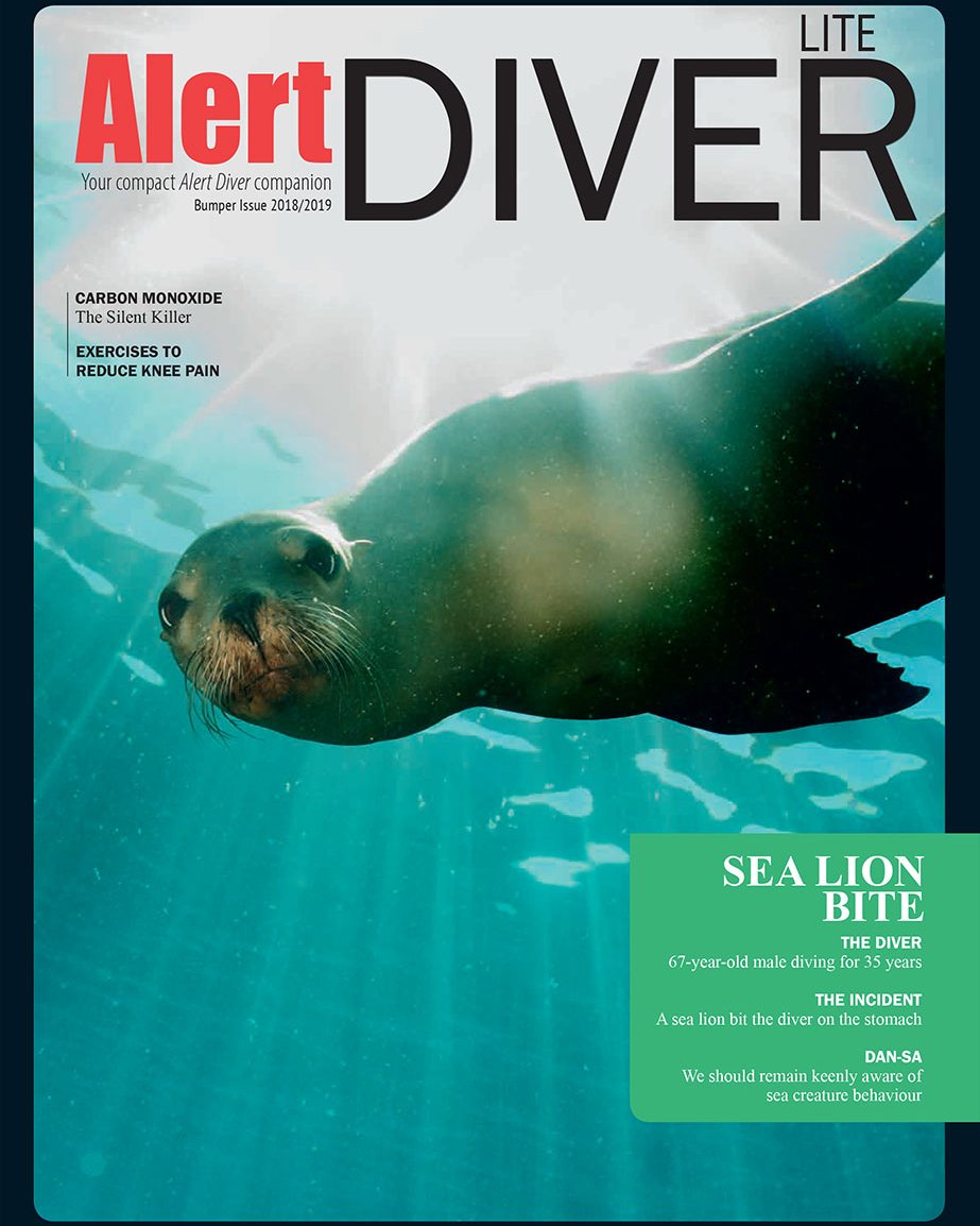 Submerge Magazine (@submergem) on Twitter photo In our latest issue of <a href="/DiveSafety/">DAN Southern Africa</a>'s Alert Diver Lite in SUBMERGE Magazine:
- Carbon Monoxide, the silent killer
- Exercises for reducing knee pain
- A sea lion bite
And more. Read online today. qoo.ly/u5sxm In our latest issue of <a href="/DiveSafety/">DAN Southern Africa</a>'s Alert Diver Lite in SUBMERGE Magazine:
- Carbon Monoxide, the silent killer
- Exercises for reducing knee pain
- A sea lion bite
And more. Read online today. qoo.ly/u5sxm
