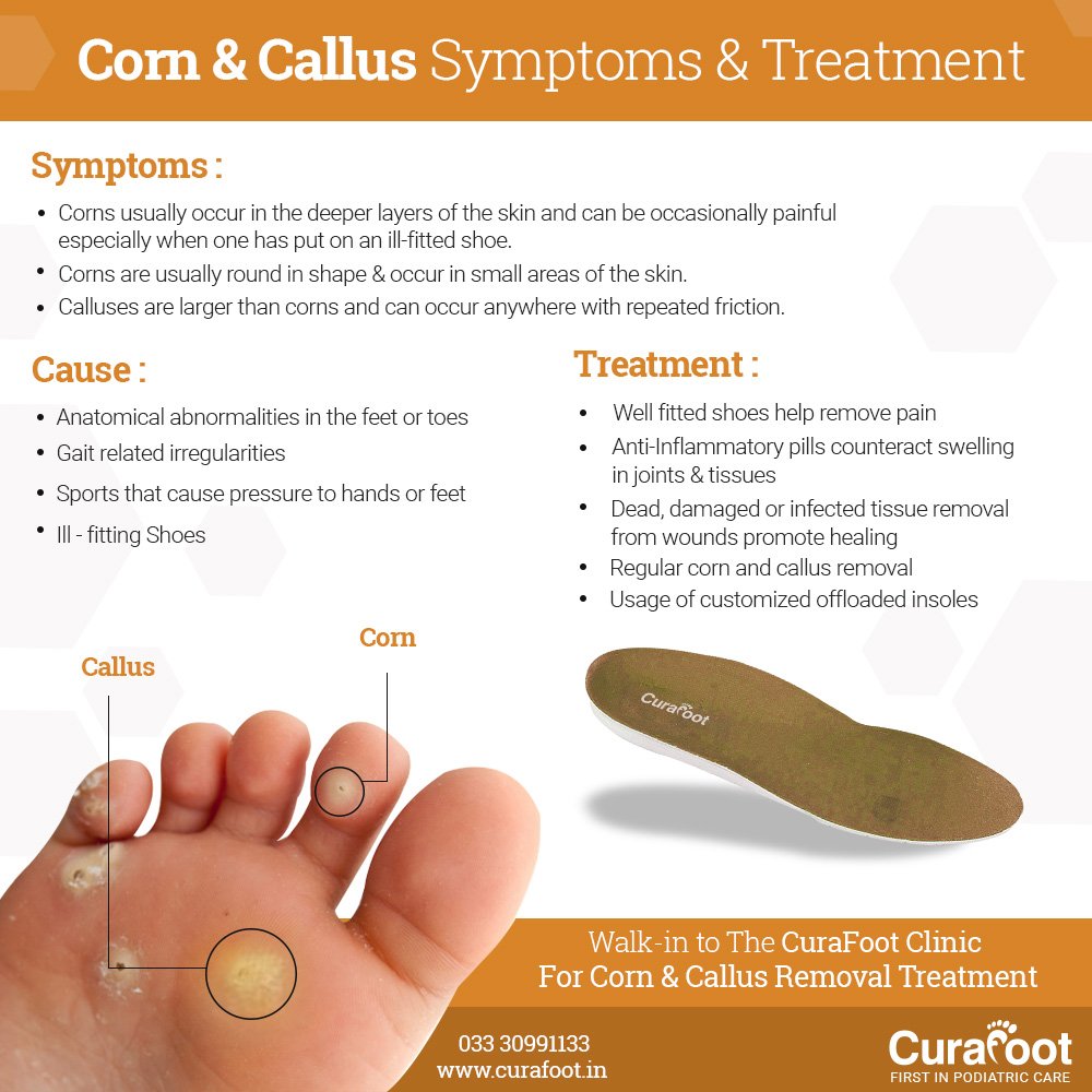 bunions corns calluses