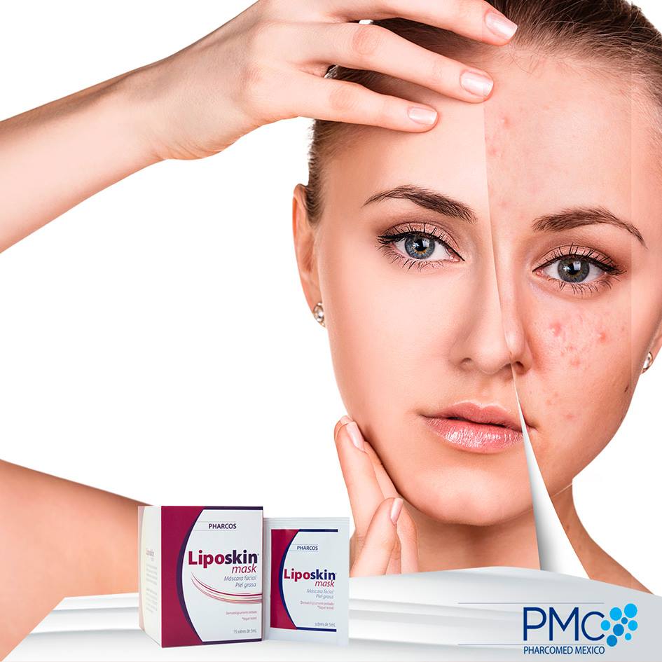 pharcomed's tweet photo. Las mujeres arriba de los 25 años pueden sufrir de brotes de acné, ya sea por cambios hormonales, por el tipo de alimentación y por estrés. Entre el 15% y el 20% de las mujeres pueden sufrir de estos brotes.
#Liposkinmask #acne #pielgrasa #Pharcomed https://t.co/k0n5bNFNUL