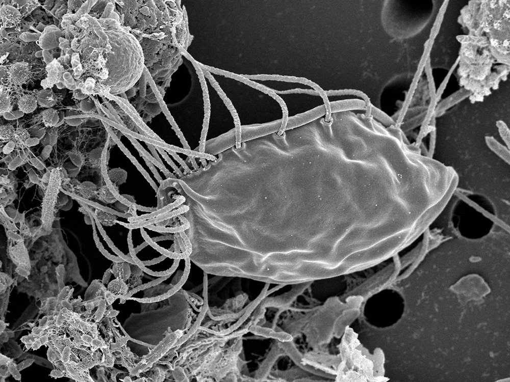 VHSScience's tweet image. Canadian researchers discovers a new kind of organism that doesn&apos;t fit into any of the five established kingdoms. Let&apos;s learn more about this flagella-waving oddball. #DalhousieU #hemimastigotes #microbiology #Science 
cbc.ca/news/technolog…