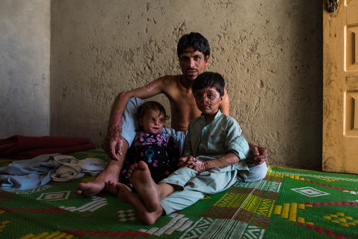 AJEnglish's tweet photo. Top 10 countries most at risk of humanitarian disaster in 2019:
• Yemen
• DRC
• South Sudan
• Afghanistan
• Venezuela
• CAR
• Syria
• Nigeria
• Ethiopia
• Somalia https://t.co/dHYceFOfyI https://t.co/KLJG52Qjc2
