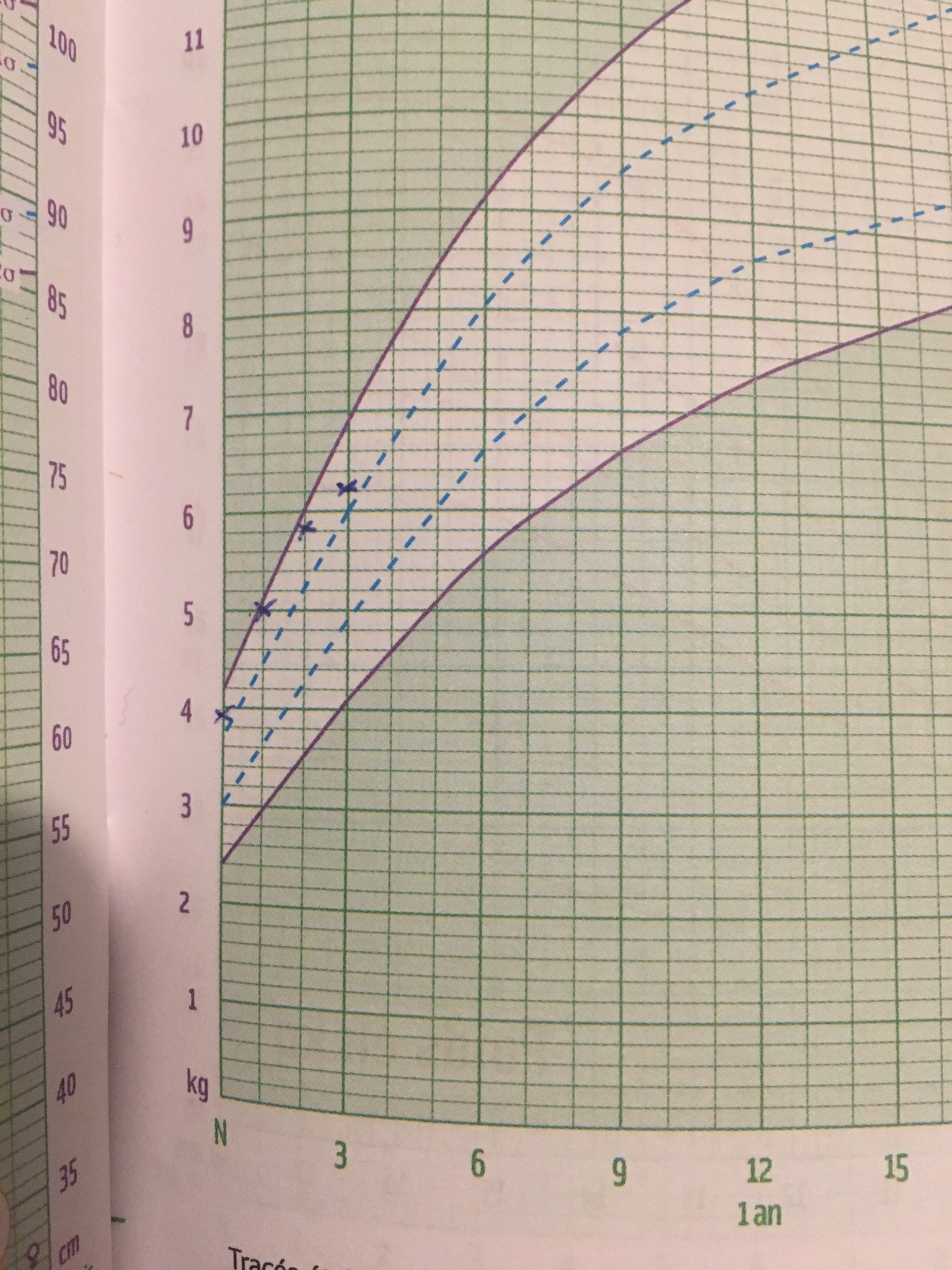 Jaddo Sur Twitter On Me Demande Ce Que Je Trouve A Redire Aux Nouvelles Courbes De Croissance Du Nouveau Carnet De Sante Les Courbes De Poids Sont Branlees Avec Les Pieds Jaddo Sur Twitter On Me Demande Ce Que Je Trouve A Redire Aux Nouvelles Courbes De Croissance Du Nouveau Carnet De Sante Les Courbes De Poids Sont Branlees Avec Les Pieds