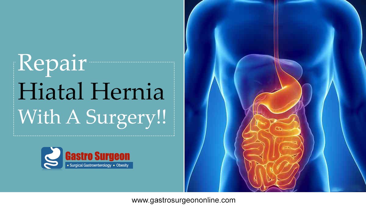 GastroSurge's tweet photo. Symptoms of Hiatal Hernia You shouldn't ignore.
*Acid reflux symptoms
*Heartburn
*Pain in upper abdomen and chest
Repair Hiatal Hernia With Surgery..
#Chennai   #Hernia_Treatment
Visit:https://t.co/KU05QSGKBO
Book your appointment: https://t.co/65F2qIi927 https://t.co/AkZyH6QigR