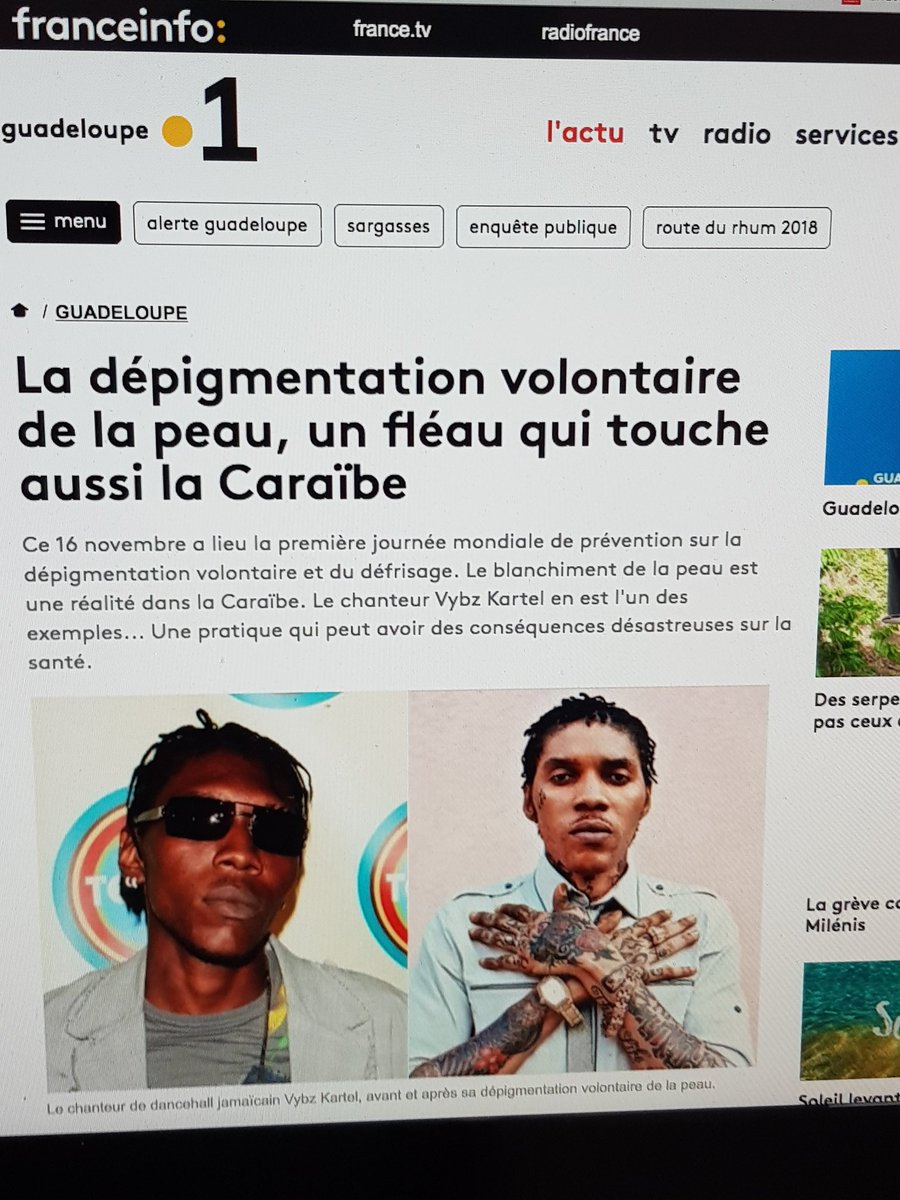 ONGLBN's tweet image. #StopSkinbleaching   #Depigmentation 
 #Guadeloupe #Caraibe 
#Colorisme   #Worldskinbleachingday18  Interview  @franceinfoplus # Merci @Mlle_Bastareaud