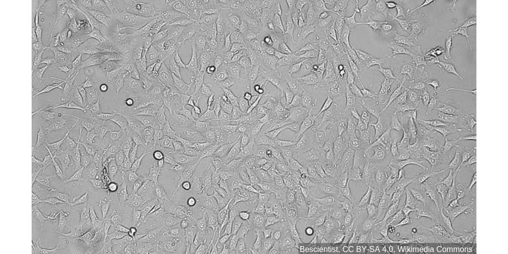 H1Connect's tweet image. The shape of #Fibroblasts: Martin A Schwarz @YaleMedicine recommends this surprising look at how #CellCompression can affect cell function. #CellBiology f1000.com/prime/73408363…