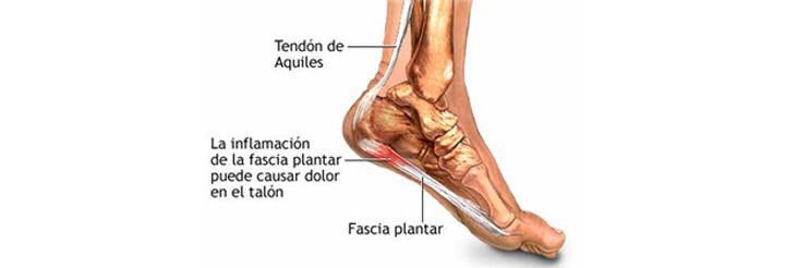 PHerbitas's tweet photo. 👣 La fascitis plantar parece una patología fácil de diagnosticar, pero tiene su complejidad y es el diagnóstico erróneo el que lleva al fracaso del tratamiento.
➡️ Aquí te explicamos en qué consiste y cómo diagnosticarla.
https://t.co/6WCsxPWvlv
#Herbitas #Podología https://t.co/ppLFUqS4iO