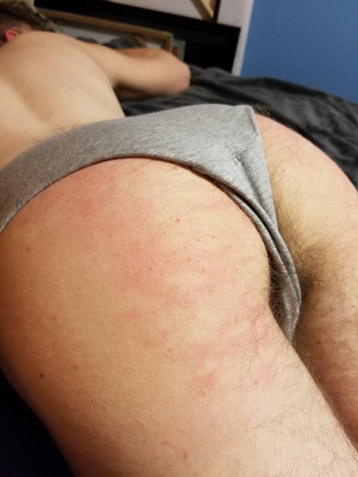 My baby's ass looking pretty and red #gfd #kink #bdsm #gentlefemdom #sadism #masochism https://t.co/<a href="/tag/gfd"class="tags">#gfd</a><a href="/tag/kink"class="tags">#kink</a><a href="/tag/bdsm"class="tags"><span>#bdsm</span></a><a href="/tag/masochism"class="tags"><span>#masochism</span></a><a href="/tag/sadism"class="tags"><span>#sadism</span></a><a href="/tag/gentlefemdom"class="tags"><span>#gentlefemdom</span></a>