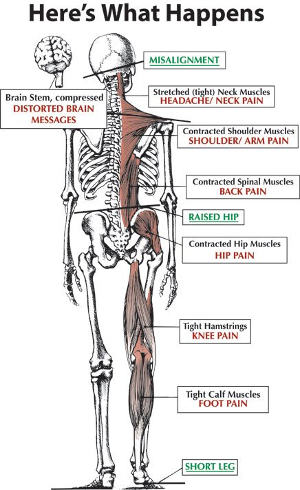 up2speedCA's tweet photo. When we have a proper structure, we have a proper function! Get your body aligned today!

#chiropracticcanhelp #alignyourbody #balancedbody #chirototherescue #headaches #kneepain #hippain #raisedhip #injuryprevention #painrelief #elbowpain #up2speedsportsperformanceandtherapy https://t.co/NtPGidW1mq