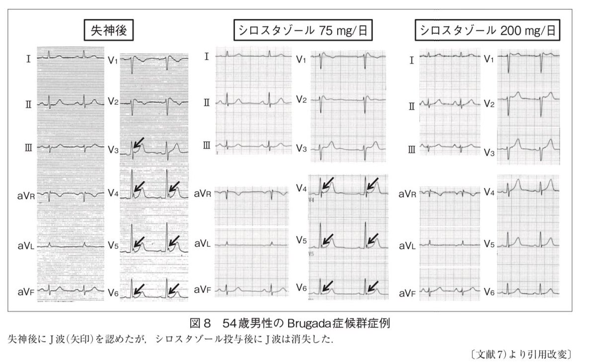 ノール イソプロ テレ 核酸のアルコール沈殿【エタノール vs.