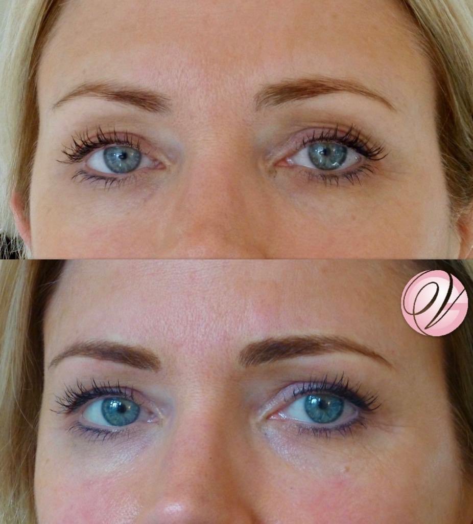 geraldinevilj03's tweet image. Wow! These eyebrows! We ever so subtly filled in the sparser areas of our gorgeous clients brows to redefine and neaten the natural shape. No one would know these aren’t her real #brows 🙌🏼 #beauty #powerbrows #permanentmakeupartist #microbladingartist #spmu #permanentmakeup