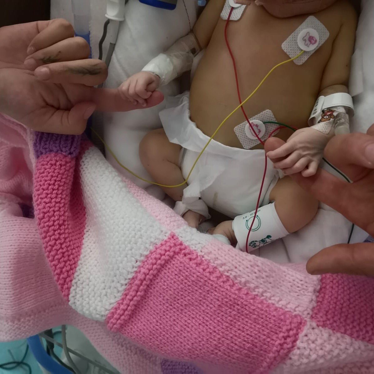MissMalinSara's tweet photo. Prayers please.. my beautiful girl CONSY was born on 23rd, 7 weeks early. She is in the great care of @GreatOrmondSt ❤️🙏🏽 https://t.co/aRpEcwcxcq