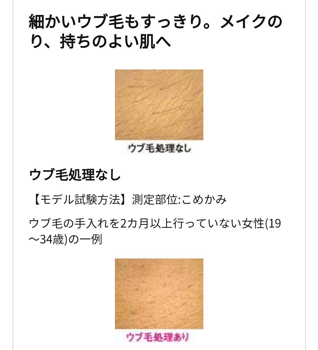 ポイズンちゃん ムダ毛処理にはパナソニックのフェリエがおすすめ ボールペン1本分くらいの大きさだから余裕で持ち運べるし 何より肌に刃が当たらないから毛が濃くならない 眉毛も剃れるし 値段も手頃 ピンクか緑がおすすめです 緑っていうかほぼ