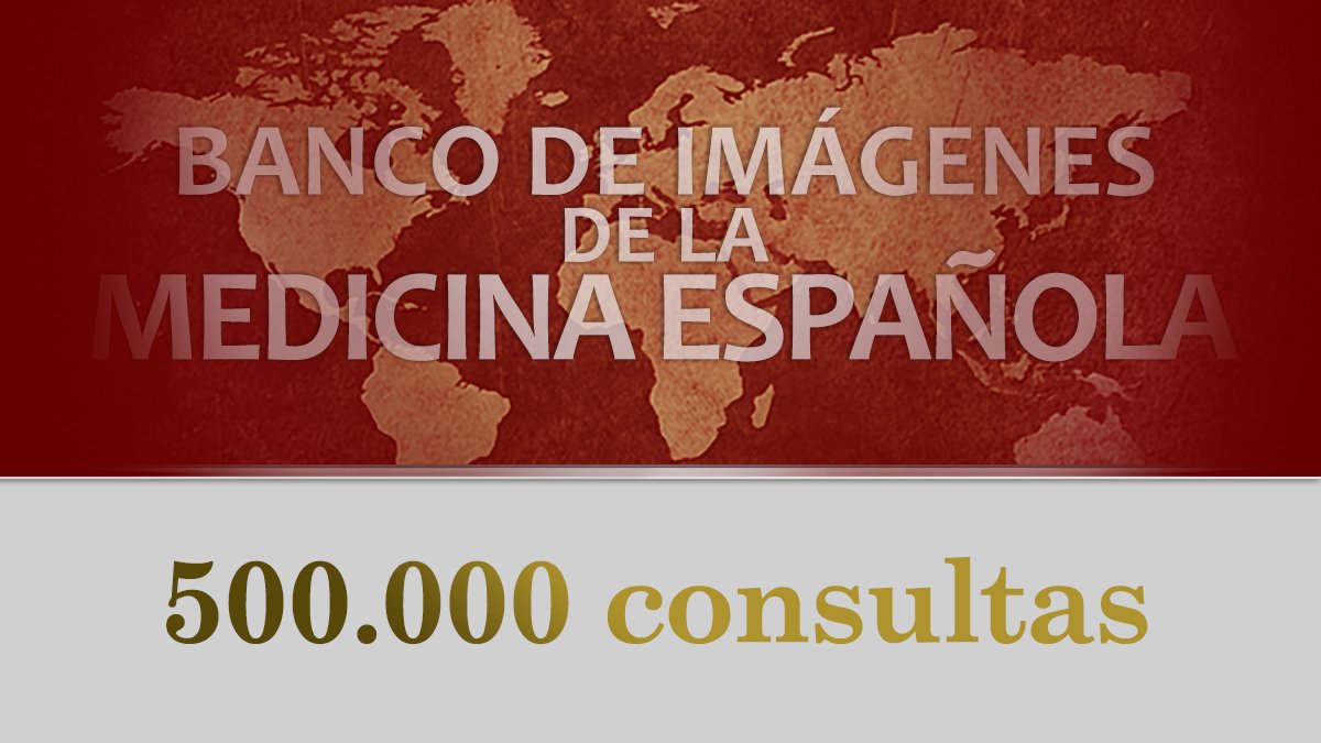ranm_es's tweet photo. Accede ya al #BIMES: El #Banco de #Imágenes de la #Medicina Española ha recibido más de 500.000 consultas. ¿No lo conoces? Lo tienes a un 'clic' de distancia. https://t.co/4LbsFTP0dw #RANM https://t.co/EkJJbqmFyf