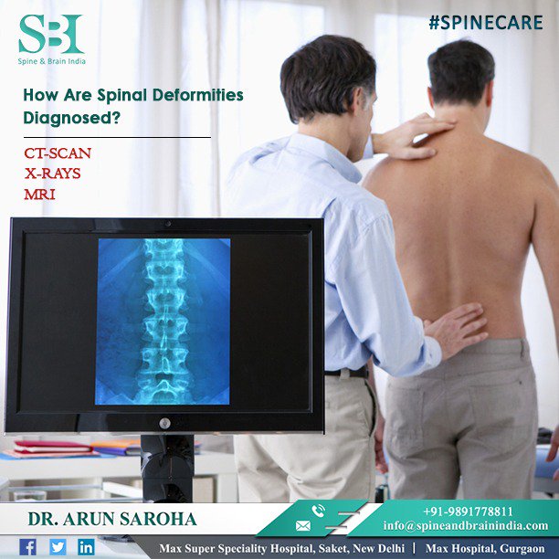spinebrainindia's tweet image. Spine deformity can happen when unnatural curvature occurs. To book an appointment bit.ly/2Rf50U0 and know more contact our Spine and Brain India expert Dr Arun Saroha @ +91-9891778811. Visit us at spineandbrainindia.com #spinehealth #SpinalDisc#Spondylolysis