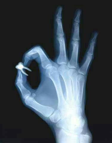 DrHunting's tweet image. Why are x-rays important? They provide dentists with information about your teeth such as bone loss, decay between teeth/under fillings, infection at the roots, and the areas they should focus on during surgery. #DentalFact #RiversideDentist