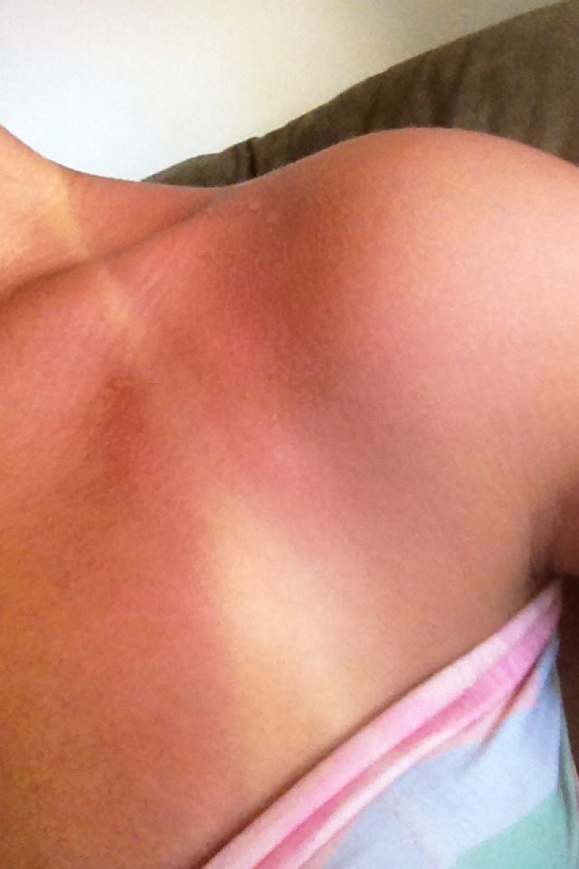 caroliss_tr's tweet photo. Nem arde https://t.co/fxUPlr0V4q