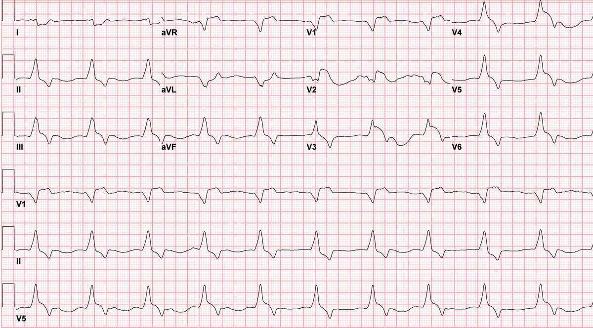 EM_RESUS tweet picture