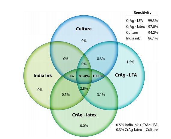 _juanj0's tweet image. #Cryptococcal Meningitis Diagnostics and Screening in the Era of Point-of-Care Laboratory Testing
jcm.asm.org/content/57/1/e…
🌕 Cultivo para el Dx
🍄 Ag para el tamizaje
🔥 &amp;lt;100 CD4+ para tamizaje
#criptococosis